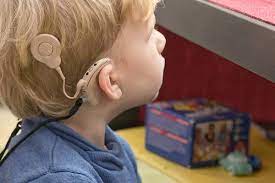 Cochlear Implants: Should Deaf people get Cochlears?
